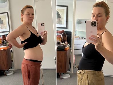 Melanie Burnicle experienced severe bloating in 2018 that persisted for years.