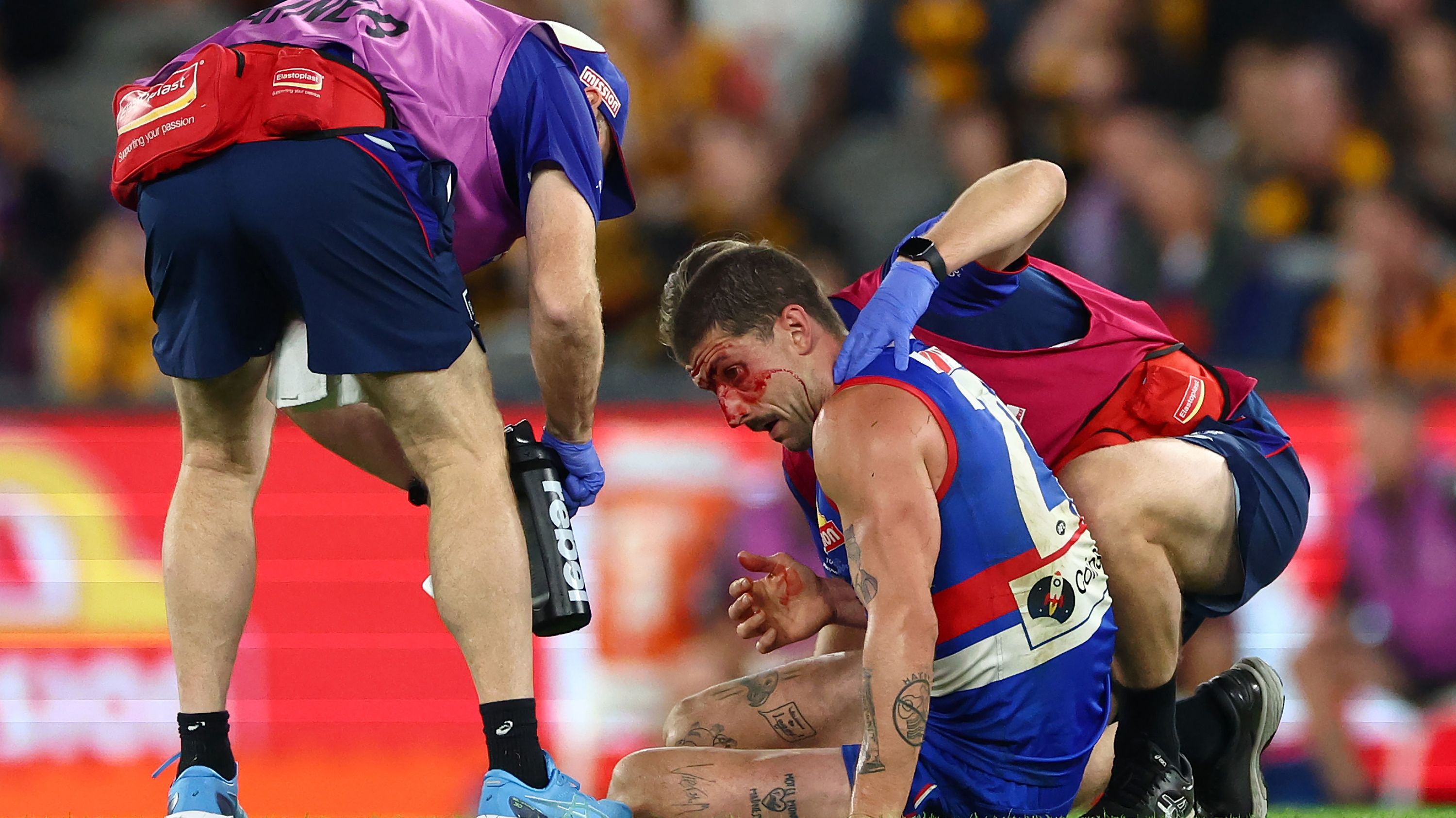 Liberatore copped a boot to the head.