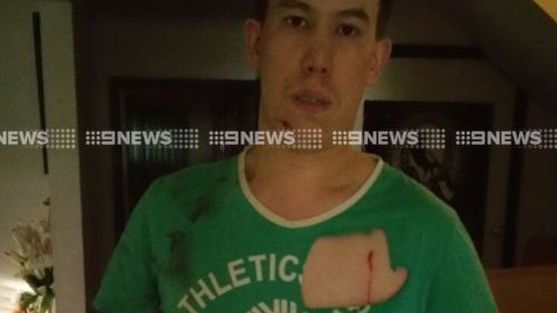 Justin Lewis was left with multiple claw marks after trying to fend off the kangaroo. (9NEWS)