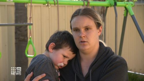 A four-year-old South Australian boy is recovering after a dog attack.