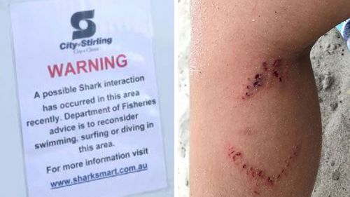 Swimmers are being asked to consider not swimming in the area, after the boy was bitten - with dramatic teeth marks seen on his leg