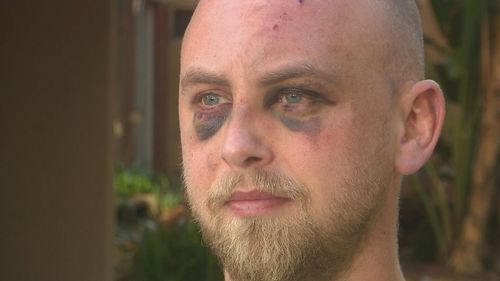 Spencer Goggin was left bloodied and bruised in a random attack while he was waiting for a taxi in Perth, with his attackers still on the run