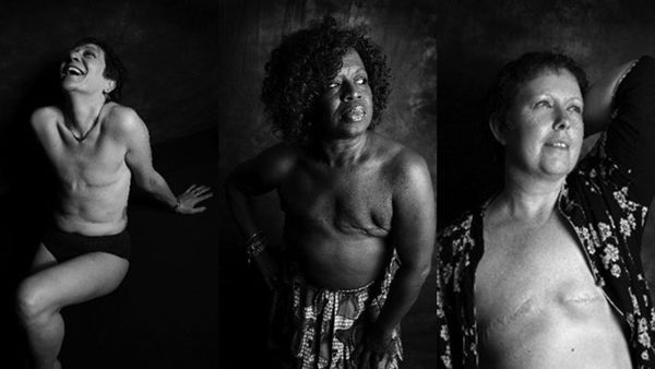 These woman are bearing their mastectomy scars to send a powerful message -  9Honey