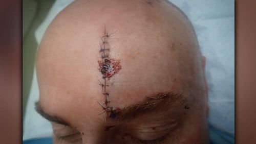 The officer required stitches following the attack. (Supplied)