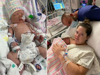 Baby Riley was born with several complex heart conditions.