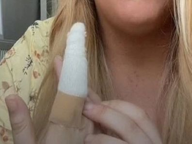 Woman finger cyst