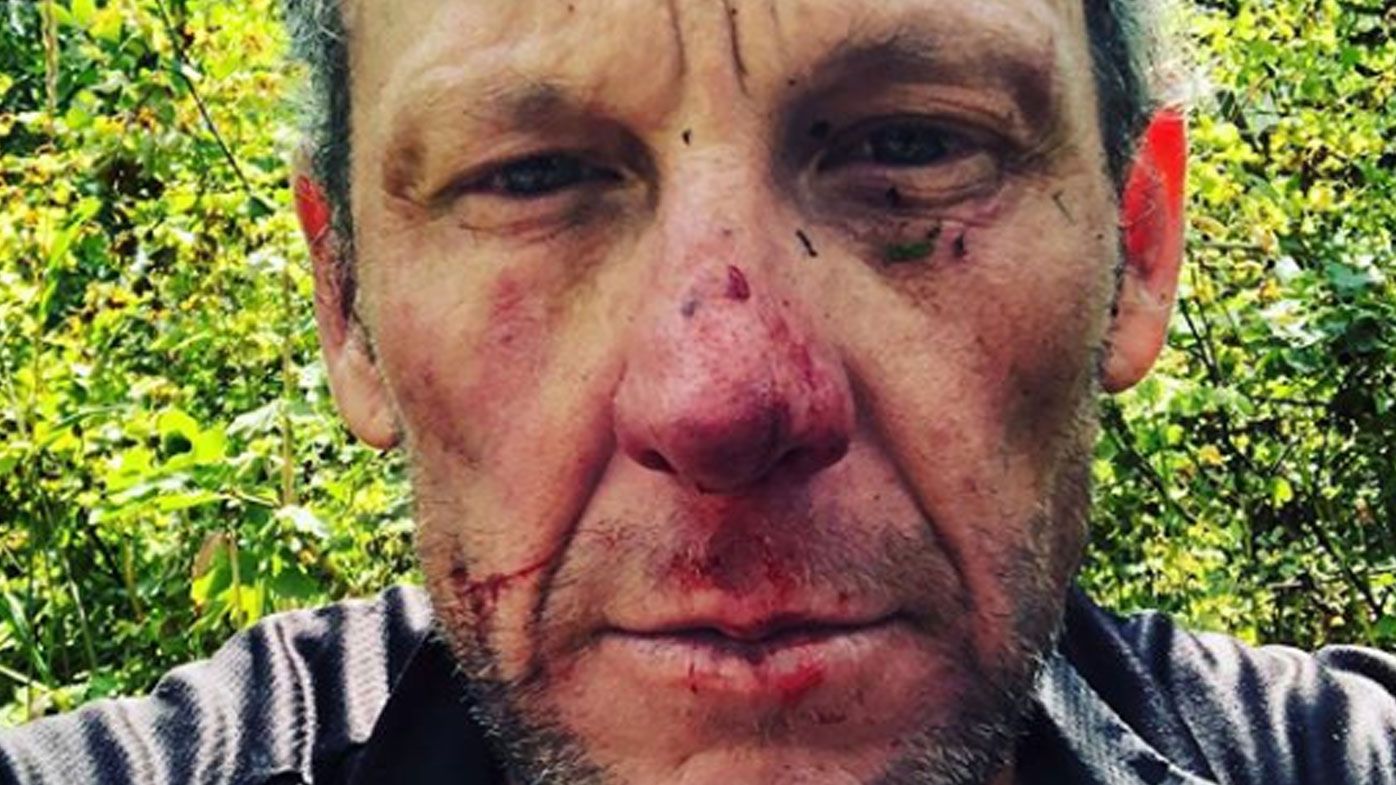 Lance Armstrong gets 'head checked' at hospital after cycling tumble