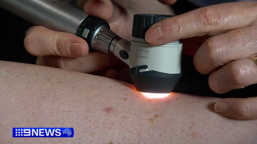 Melanoma machine queensland