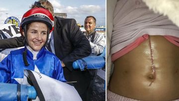 Michelle Payne and the photo of her massive scar. (AAP)