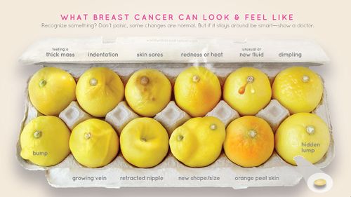 #KnowYourLemons photo goes viral amid call for ‘real awareness’ about breast cancer