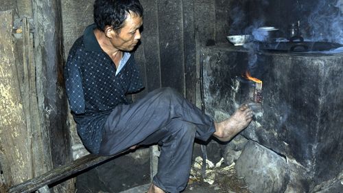 Mr Xinyin has taught himself to use his feet to farm and cook. (AAP)