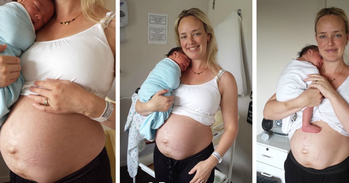 Inspiring mother shares photo diary of her post-baby body 