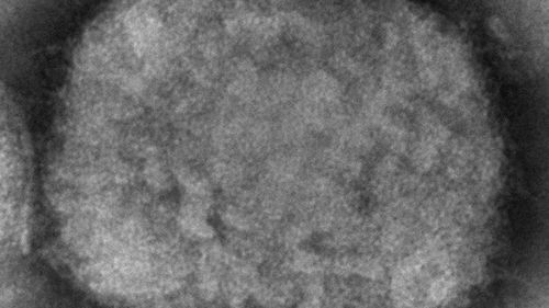 This 2003 electron microscope image, provided by the Centers for Disease Control and Prevention, shows a monkeypox virion obtained from a sample linked to the 2003 prairie dog outbreak. Monkeypox, a disease rare outside Africa, has been identified in recent days. by European and American health authorities.  (Cynthia S. Goldsmith, Russell Regner/CDC via AP)
