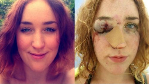 Woman posts horrific photo after brutal carnival assault