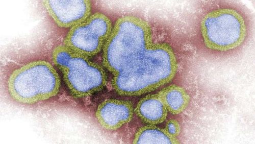 Influenza A is a particularly nasty virus spreading around Australia.