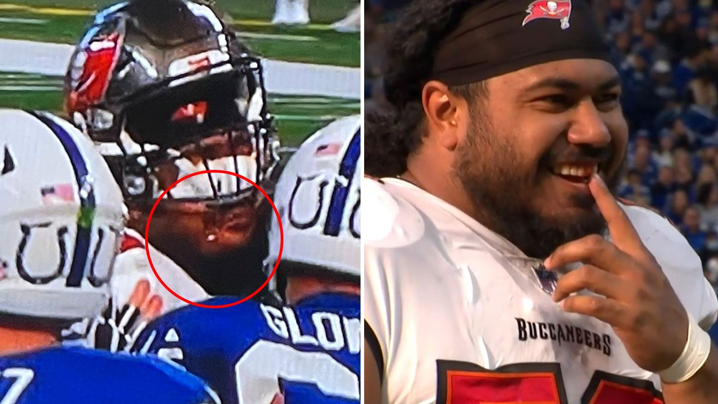 'Does the tooth fairy come?': Tampa Bay Buccaneers defensive lineman Vita Vea loses tooth mid-game