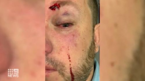 NSW police sergeant attacked