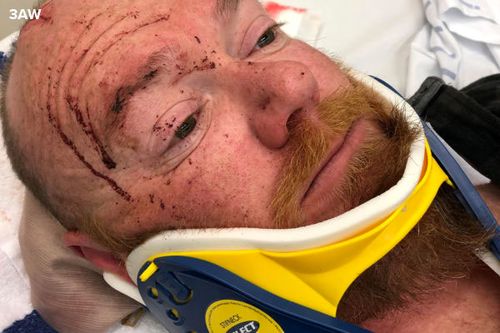 The senior constable was taken to hospital following the attack, and required a dozen stitches on his head. (3AW)