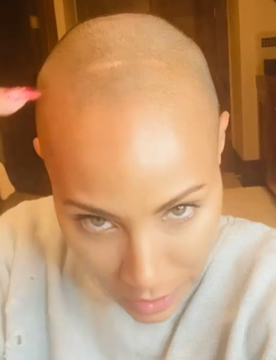 Jada Pinkett Smith hair loss