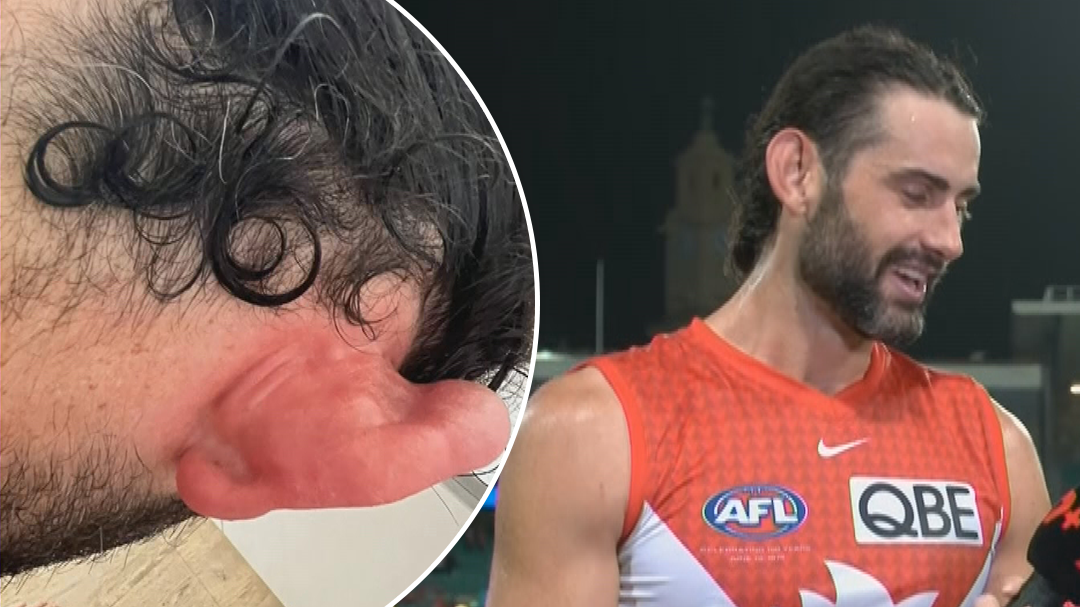 EXCLUSIVE: Matthew Lloyd's big call on future of luckless 'workhorse' Brodie Grundy