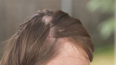 Dr Pimple Popper on 9Now - twins Tracie and Stacie