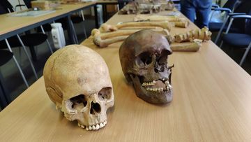 Two skulls were among the human remains discovered in the Belgian attic. They displayed signs of extreme violence.