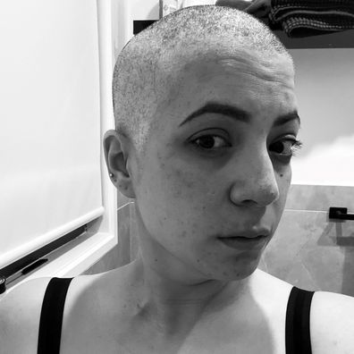 Lana lost her hair following her treatment. 
