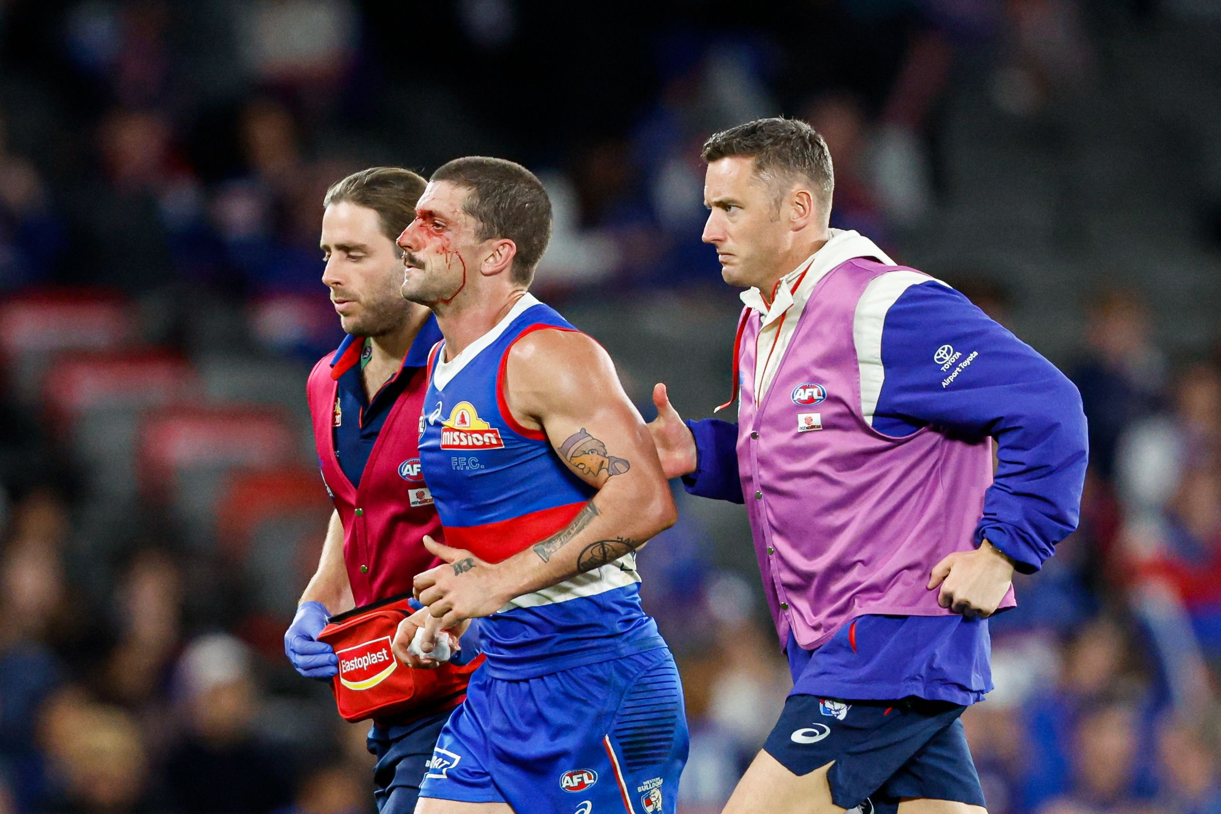 Western Bulldogs star Tom Liberatore ruled out "indefinitely" after second scary concussion