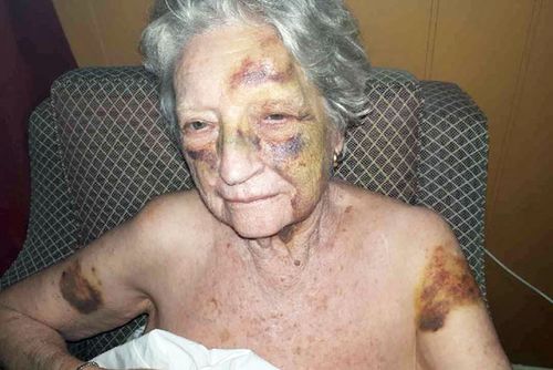 Margaret Heffernan's family believe she was assaulted in her Sydney nursing home.