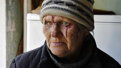 Injured Natalia Rudneva, 59, reacts as her son was hospitalised after night shelling in Kramatorsk, Ukraine,