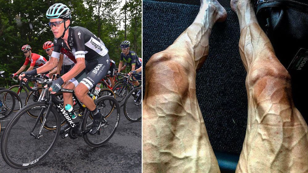 Polish rider Pawel Poljanski's legs tell the story of a tough Tour de France. (AAP, Instagram)