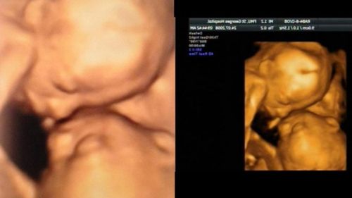 WA woman charged after allegedly selling fake ultrasound photos to expectant mothers