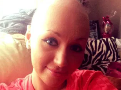 Young woman Emma UK dies cervical cancer refused pap test