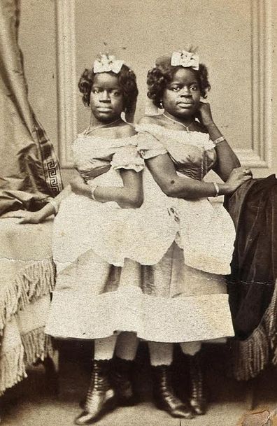 Millie and Christine McKoy in 1871.