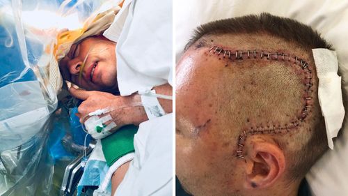 Mr Stephens' brain was operated on while he was awake at Sir Charles Gairdner Hospital.