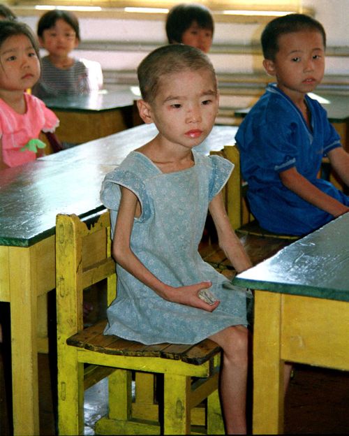 Nine and 10-year-old children looking like three or four-year-olds in a kindergarten due to famine in the southern resort of Hui Chong in North Korea.