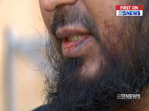 The driver was chased to Whitehorse Road before the thieves stole his mobile phone and fled on foot. Picture: 9NEWS.