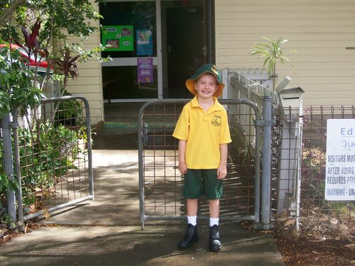 He had his first open heart surgery when he was nine months old and his second just before starting school. (Supplied)