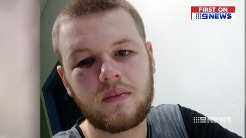 Tioram McDonough was left bruised following the assault.