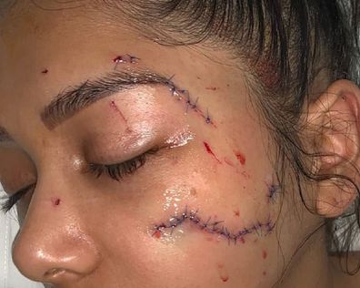 Parramatta DV victim glassed by ex-boyfriend