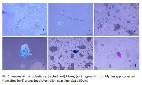 Images of some of the microplastics extracted from the blue mussels samples.