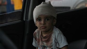 Wounded Palestinians, injured following Israeli air raids, visit Al-Shifa Hospital for treatment