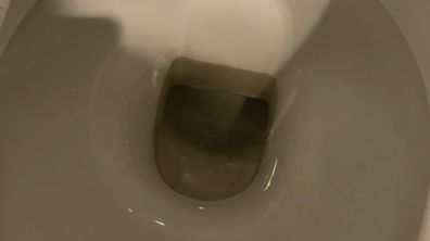 remove water stains in toilet