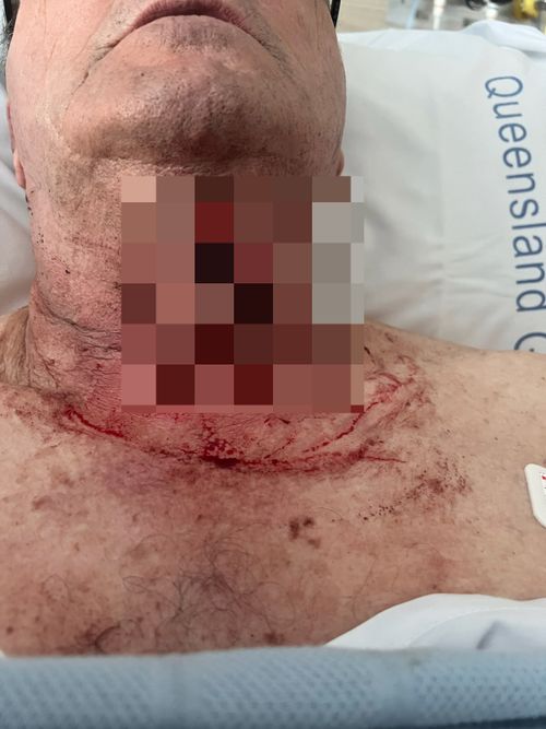 Bus driver allegedly stabbed in Caloundra