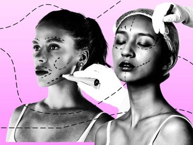 Meet the 30 somethings having facelifts consultationIn 2023, the number of facelift patients in the US aged between 20-29 and 30-39 each jumped by 7% compared to the previous year. 