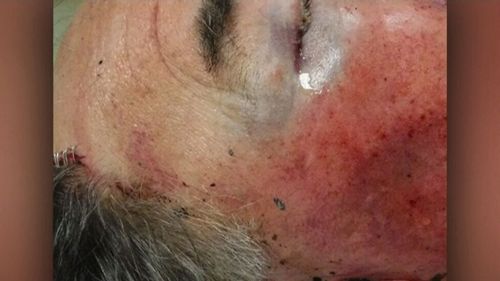 Police have released images of the 71-year-old's head wounds. (9NEWS)