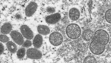This electron microscopic (EM) image depicted a monkeypox virion, obtained from a clinical sample associated with the 2003 prairie dog outbreak. It was a thin section image from of a human skin sample. On the left were mature, oval-shaped virus particles, and on the right were the crescents, and spherical particles of immature virions. High Resolution:	Click here for hi-resolution image (5.21 MB) Content Providers(s):	CDC/ Cynthia S. Goldsmith Creation Date:	2003 Photo Credit:	Cynthia S. Goldsmi