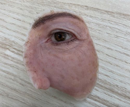 The eye prosthetic created by Sophie Fleming for Tracey Sims.  