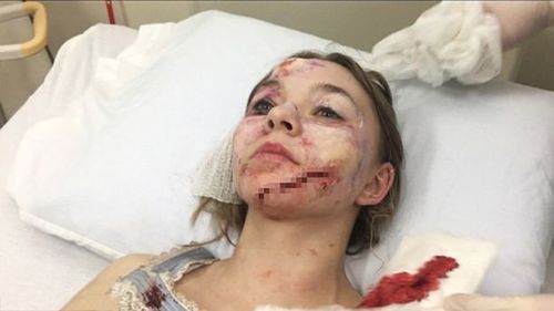 The Canadian actress was hospitalised with significant facial injuries.  (Tapper Cuddy LLP)