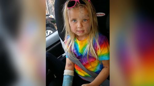 Melbourne mum slams authorities after five-year-old mauled by pitbull cross